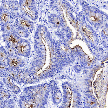 MUC17 Recombinant Rabbit mAb (SDT-3951-56)