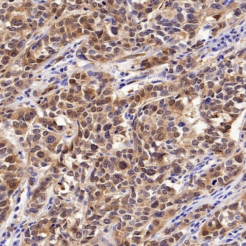 CDKN2A/p16 INK4A Recombinant Mouse mAb (SDT-4677)