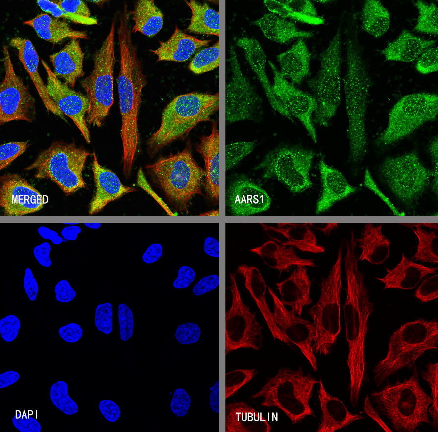 AARS1 Rabbit Polyclonal Antibody