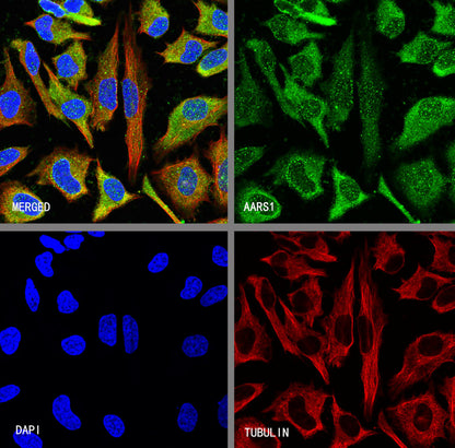 AARS1 Rabbit Polyclonal Antibody