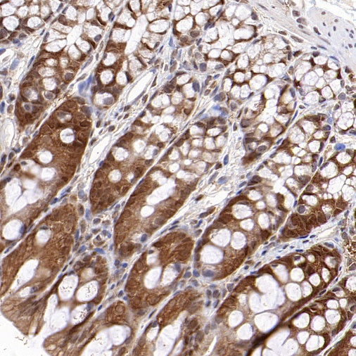 ASC/TMS1 Rabbit Polyclonal Antibody