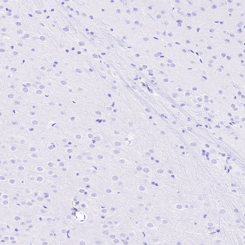 Sialoadhesin/CD169 Recombinant Rabbit mAb (SDT-3228-8)