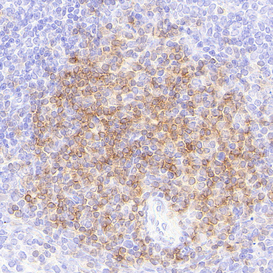 CD4 Recombinant Rabbit mAb (S-6203)