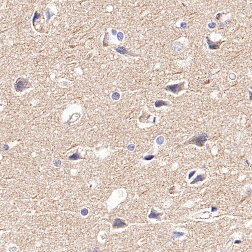 DLST Rabbit Polyclonal Antibody