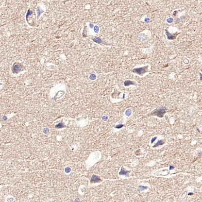 DLST Rabbit Polyclonal Antibody