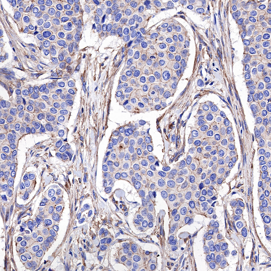 α-Actinin-1 Recombinant Rabbit mAb (SDT-311-20)