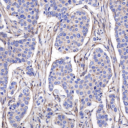 α-Actinin-1 Recombinant Rabbit mAb (SDT-311-20)