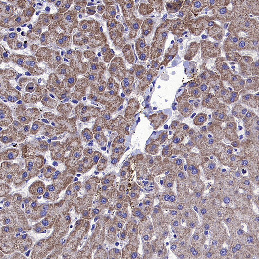 ALDH2 Rabbit Polyclonal Antibody