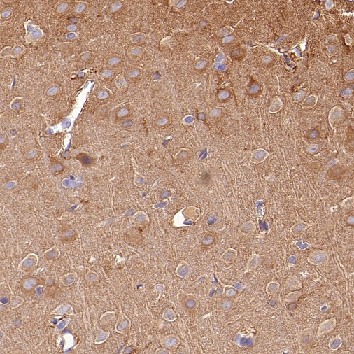PFKL+PFKM Recombinant Rabbit mAb (S-1302-31)