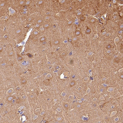 PFKL+PFKM Recombinant Rabbit mAb (S-1302-31)