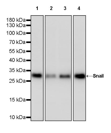 Snail Recombinant Rabbit mAb (S-3257)