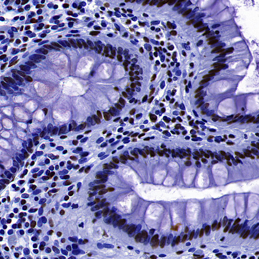 Histone H3 Recombinant Rabbit mAb (S-5672)