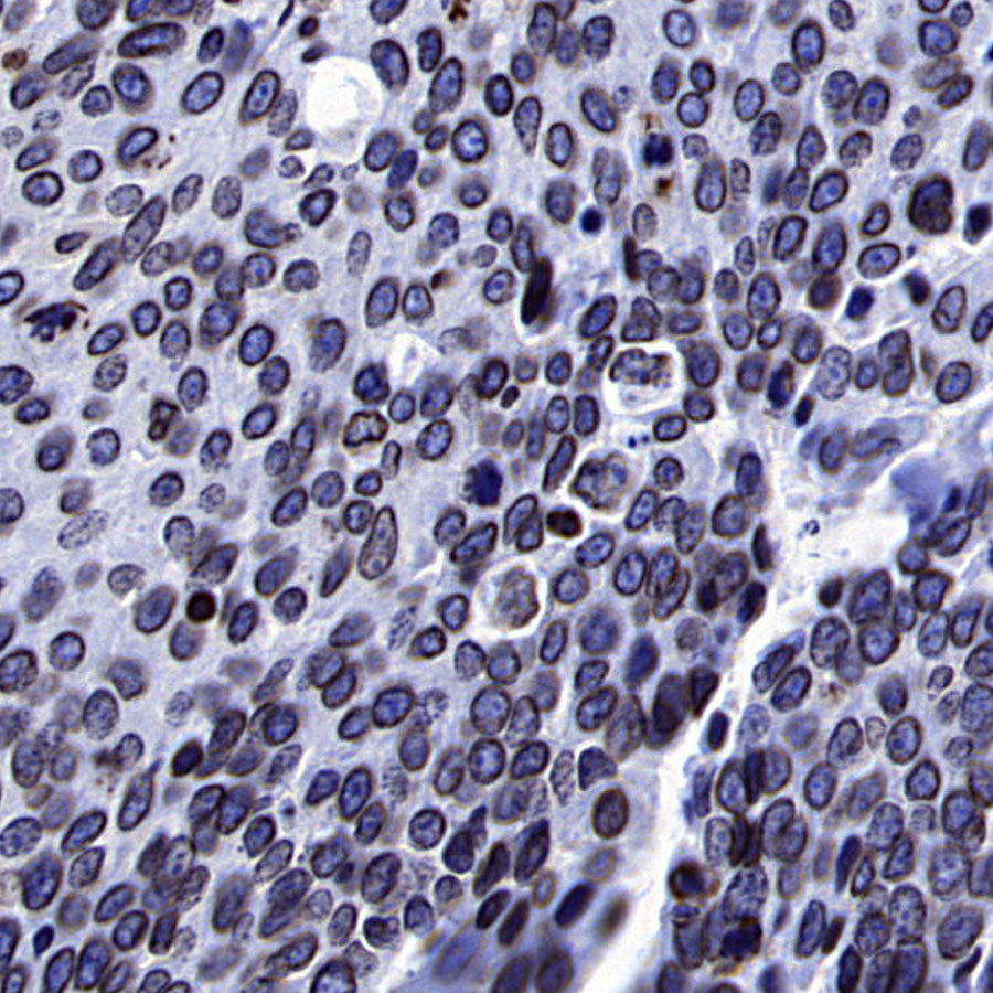 Lamin B1 Recombinant Mouse mAb (S-4865)