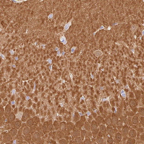 UCHL1 Recombinant Rabbit mAb (S-1765-38)