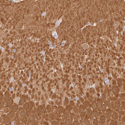 UCHL1 Recombinant Rabbit mAb (S-1765-38)