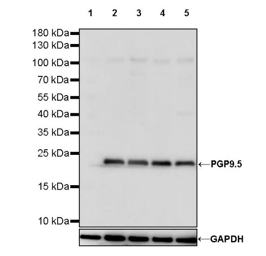 PGP9.5 Recombinant Rabbit mAb (SDT-665-37)