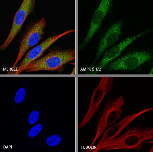 AMPKβ1/2 Recombinant Rabbit mAb (S-2728-26)