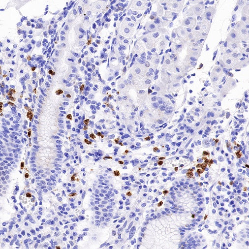 CXCR2 Recombinant Rabbit mAb (S-1292-30)