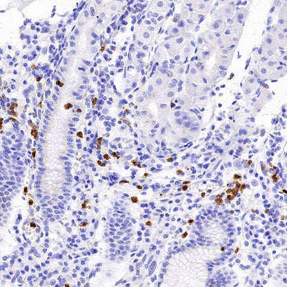 CXCR2 Recombinant Rabbit mAb (S-1292-30)