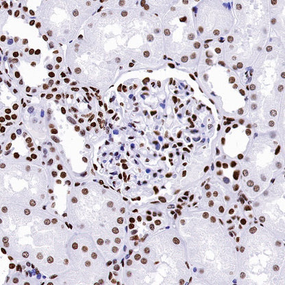 Histone H4 (acetyl K5) Recombinant Rabbit mAb (S-1464-112)