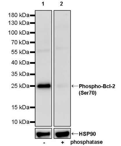 Phospho-Bcl-2 (Ser70) Recombinant Rabbit mAb (S-1344-257)
