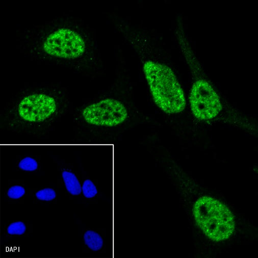 RNA polymerase II CTD repeat YSPTSPS (phosphor S7) Recombinant Rat mAb (S-R198)