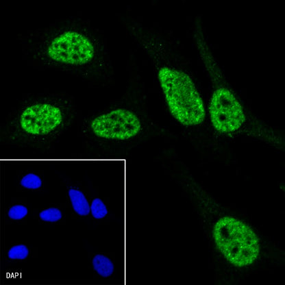 RNA polymerase II CTD repeat YSPTSPS (phosphor S7) Recombinant Rat mAb (S-R198)