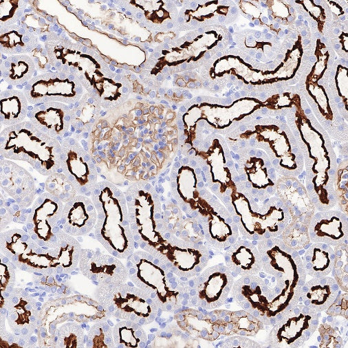 Ezrin Recombinant Rabbit mAb (S-R358)