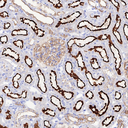 Ezrin Recombinant Rabbit mAb (S-R358)
