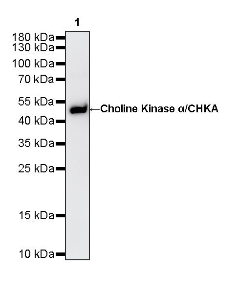Choline Kinase α/CHKA Recombinant Rabbit mAb (S-4422-31)