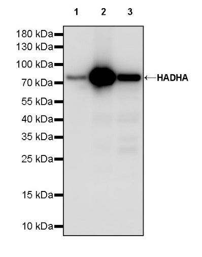 HADHA Recombinant Rabbit mAb (S-2345-8)