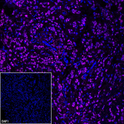 FOXA1 Recombinant Rabbit mAb (SDT-2779-17)