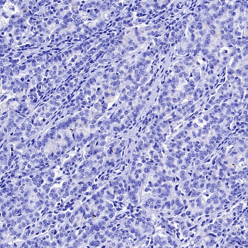 ATP4B Recombinant Rabbit mAb (SDT-2445-64)