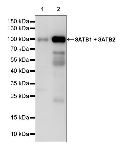 SATB1 + SATB2 Recombinant Mouse mAb (S-3382)