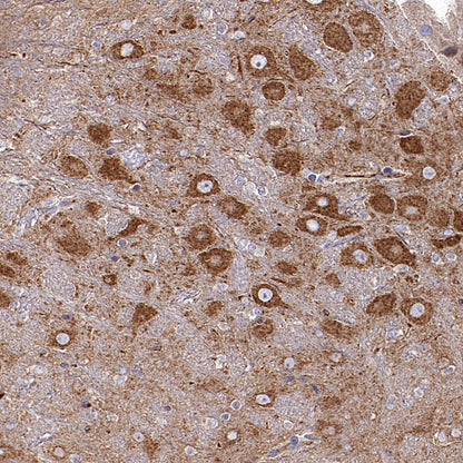 FUNDC1 Rabbit Polyclonal Antibody