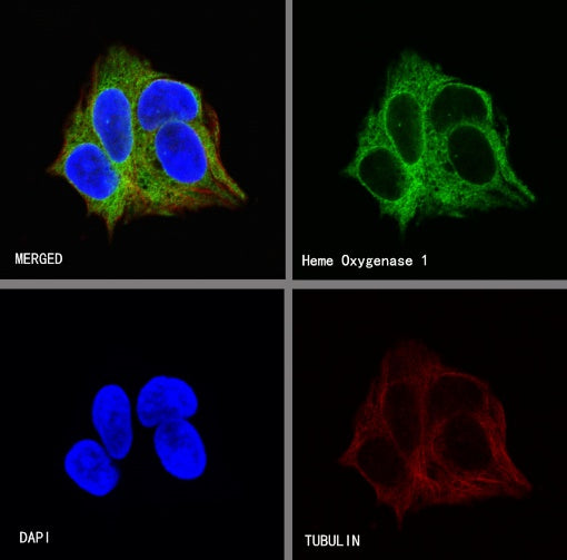 Heme Oxygenase 1 Recombinant Rabbit mAb (S-R334)