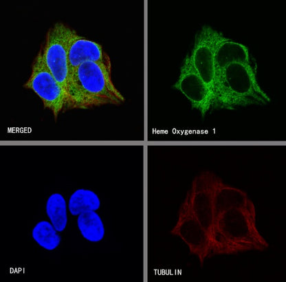 Heme Oxygenase 1 Recombinant Rabbit mAb (S-R334)