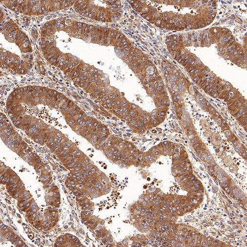 DRP1 Recombinant Rabbit mAb (S-1927-27)