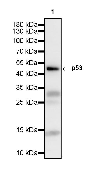 p53 Recombinant Rabbit mAb (S-3975-17)