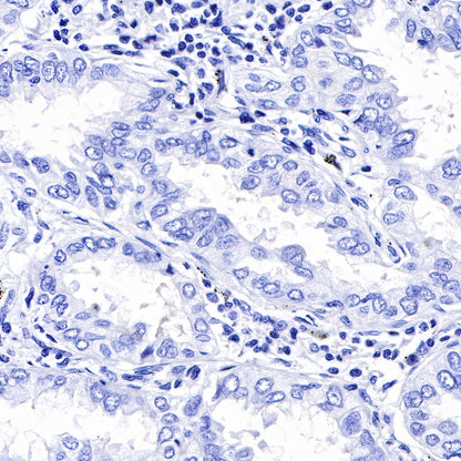 keratin 6 Rabbit mAb (SDT-015-69)