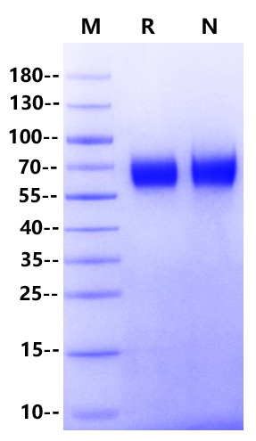 TPBG/5T4 His Tag Protein, Cynomolgus/Rhesus macaque