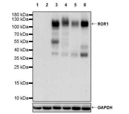 ROR1 Recombinant Rabbit mAb (SDT-R502)