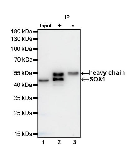SOX1 Recombinant Rabbit mAb (S-R310)