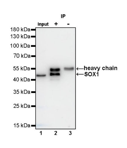 SOX1 Recombinant Rabbit mAb (S-R310)
