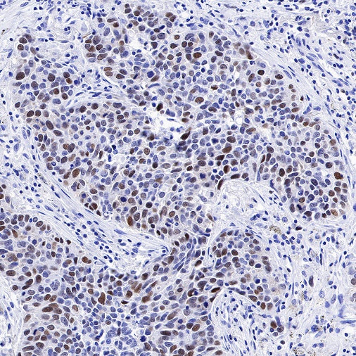 CHAF1b Recombinant Rabbit mAb (S-R316)