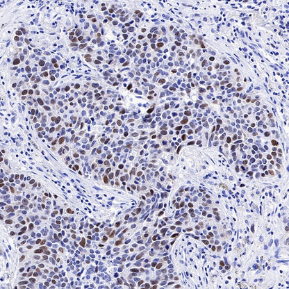 CHAF1b Recombinant Rabbit mAb (S-R316)