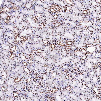 Histone H4 (acetyl K16) Recombinant Rabbit mAb (S-1482-12)