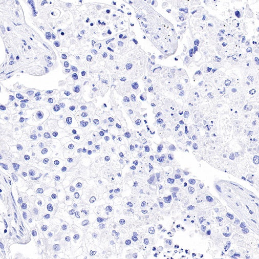 Estrogen Receptor α Recombinant Rabbit mAb (SDT-R371)