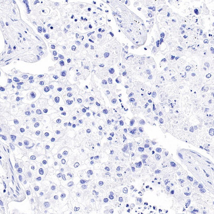 Estrogen Receptor α Recombinant Rabbit mAb (SDT-R371)