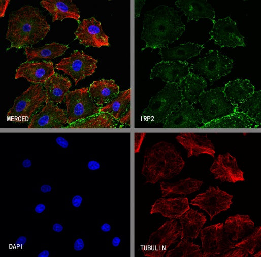 IRP2 Recombinant Rabbit mAb (S-4592-56)